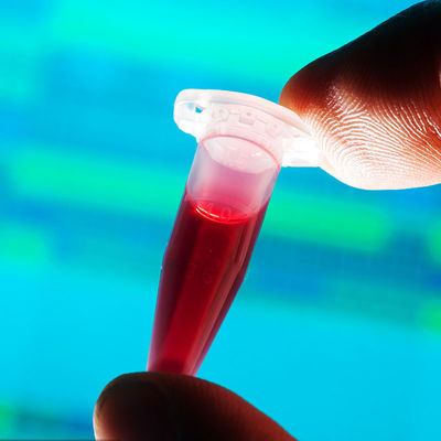 مختبرات الاختبار المعتمدة من إدارة الأغذية والعقاقير (FDA) - الكشف السريع عن الأغذية الملامسة للرضع - خدمة المصادقة من طرف ثالث